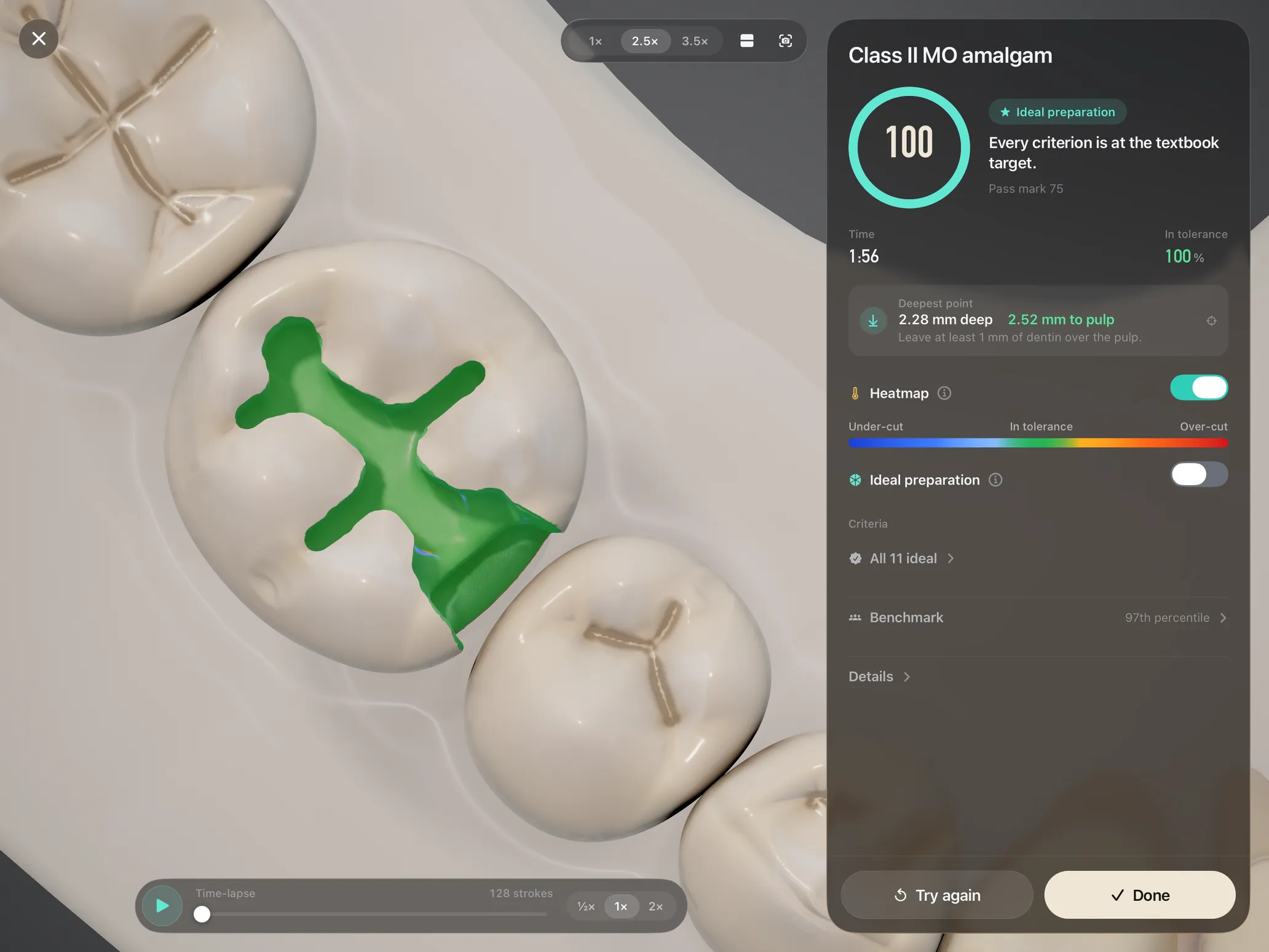 Handpiece on iPad: an ideal Class II MO amalgam preparation scoring 100, with a green in-tolerance heatmap over the cut, the deepest point 2.28 mm deep and 2.52 mm from the pulp, all 11 criteria ideal and the 97th percentile benchmark.
