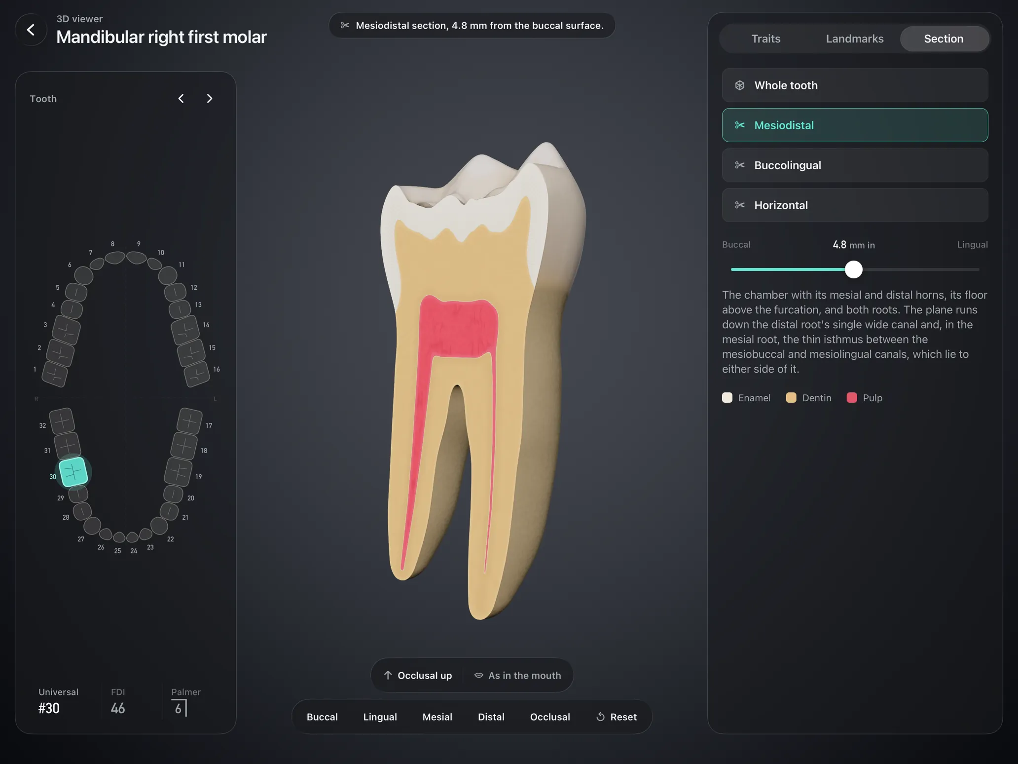 Handpiece 3D viewer on iPad: a mesiodistal section of the mandibular right first molar 4.8 mm from the buccal surface, showing the pulp chamber with its horns and both canals, beside the arch map and the section controls.