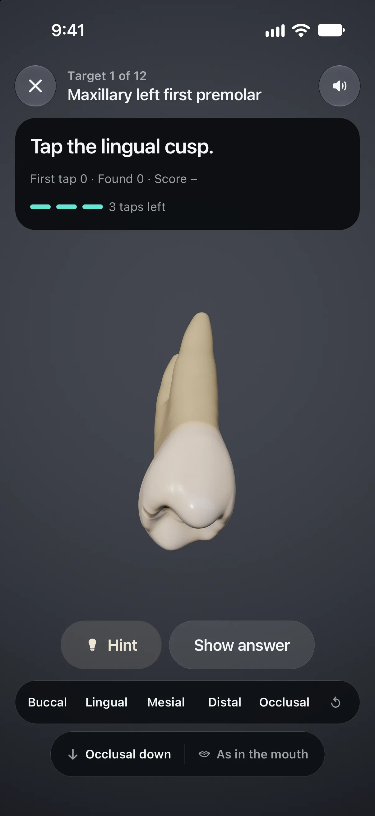 Handpiece landmark hunt on the maxillary left first premolar asking the student to tap the lingual cusp, with three taps left and buccal, lingual, mesial, distal and occlusal views.